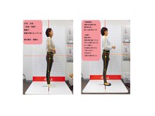 アクア治療院 伏古/産後3ヶ月矯正の変化