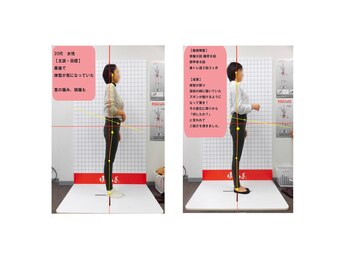 アクア治療院 伏古/産後3ヶ月矯正の変化