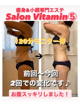 サロン ビタミンファイブ(Salon Vitamin5)/50歳モニター様、2回での変化！