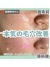【ニキビケア】毛穴洗浄+ハーブピーリング+ニキビケア◎¥7,800
