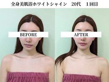 サンビ(SANBI)/透明感あふれる美白肌に♪