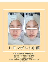 ソワナ(soina)/【神楽坂駅/フェイシャル/毛穴】