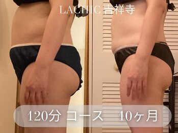ラシク 吉祥寺(LACHIC)/お腹中心に全身施術