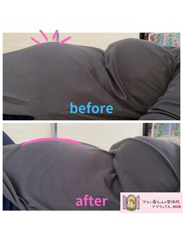 ママラヴィ(MamaLavie)/マタニティ(妊婦)のお悩み解決