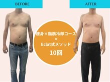 エクラ(Eclat)/Eclatの痩身★BeforeAfter6