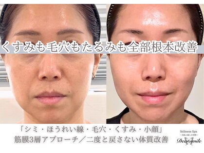 ディアスマイル(Dear.smile)の写真