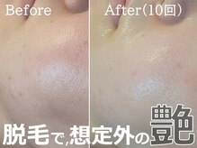 ルナステラ 七尾店の雰囲気（産毛脱毛で毛穴も目立たなく！つるんと陶器のような艶肌へ◎）