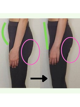 バストラボ 仙台店の写真/【要チェック☆】ピラティスや運動で変わらなかった人!お腹ぽっこり解消!くびれ出現!20分で変化を実感!