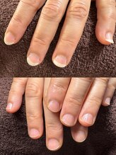 ビビィ(vivie)/縦筋のお爪、育てませんか？