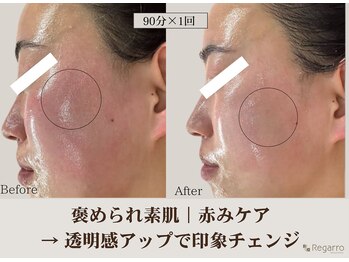 レガロビューティクリエイションズ桜川店/褒められ素肌│赤みケア