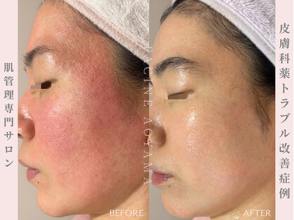 ファシネアオヤマ(FACINE AOYAMA)の写真