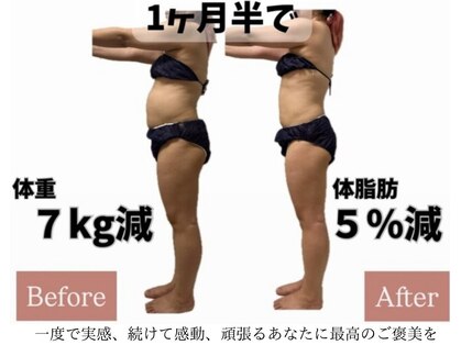 YOSAPARK Bijouの写真
