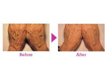 ヴィジュール(Vi-joule)/ダーマドロップセラピー