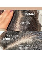 シュール センター南(SURREAL)/ヘッドスパ後のビフォーアフター