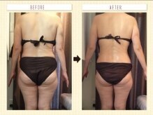 美容整体ウェリナ あま甚目寺院/小顔矯正/骨盤矯正/美脚サロン