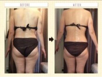 美容整体ウェリナ あま甚目寺院/小顔矯正/骨盤矯正/美脚サロン