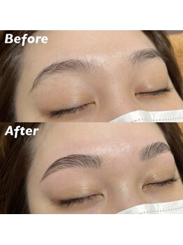 キンキー 広島(kinky)/