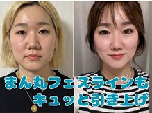 ルイール(LUIRE)の雰囲気（表情筋トレーニングで老けない顔！重力に負けない顔をつくる！）