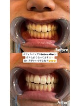 アレッド 大阪店(ared.)/デート・結婚式前に