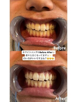 アレッド 大阪店(ared.)/デート・結婚式前に