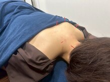 代官山アサ接骨院 鍼灸院(代官山 Asa 接骨院 鍼灸院)/自律神経や女性特有のお悩み解消