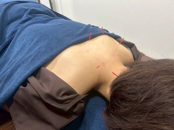 代官山アサ接骨院 鍼灸院(代官山 Asa 接骨院 鍼灸院)/自律神経や女性特有のお悩み解消