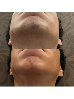 フェリーバ 流山店(FELIVA)/綺麗スッキリ♪