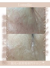 ルネル(Lunelle)/若いからって油断してない？？