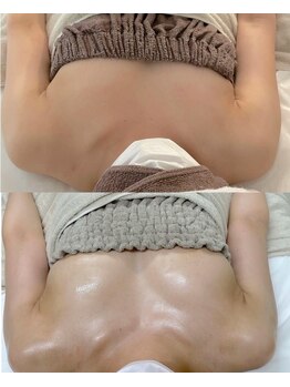 ワイサロン(Y salon)/産後バストアップ/4ヶ月