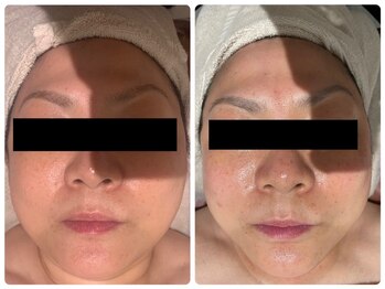 ルナグランデ(Luna grande.)/効果写真