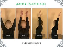 ボディ リセット アンド デザイン(Body Reset & Design)/【施術例】ビフォーアフター