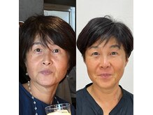 ターンオーバーセラピーの雰囲気（【天然松ヤニWAX】シミケア、シワケア弾力UPもオススメ◎）