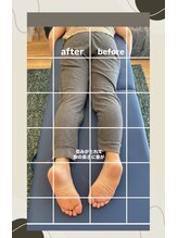 リンパアクティベーション オオサカ(リンパアクティベーション Osaka)/歪みが取れて脚の長さに差が