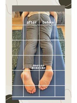 リンパアクティベーション オオサカ(リンパアクティベーション Osaka)/歪みが取れて脚の長さに差が