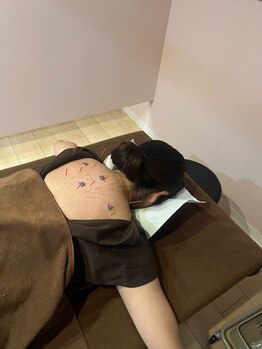 ココロ(CoCoLo)/美容鍼灸