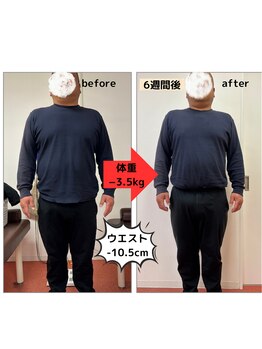 たかみや鍼灸接骨院/耳つぼ＋食事調整でダイエット