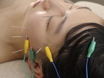 ラビィ(lovie)/電気美容鍼