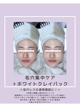 ソワナ(soina)/【神楽坂駅/フェイシャル/毛穴】