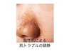 【徹底脂性肌改善】REVIハーブピーリング+毛穴ケアOP+韓国毛穴洗浄¥22000→