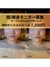 【顔*痩身モニター】サーマル×EMS/HV小顔コルギ/脂肪太り/たるみ食いしばり