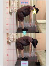 鍼灸 整体院 ひわたし/◇腰の痛みで曲げられない！