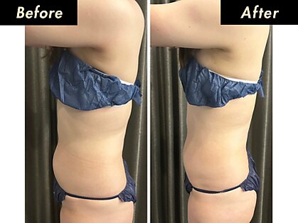 ザ ウィンバックサロン(THE WINBACK SALON)の写真