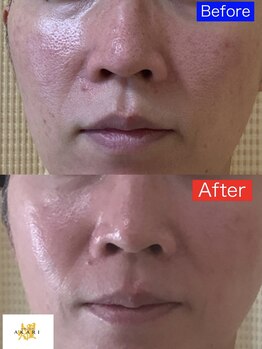 エナジーサロン アカリ(燿)/セルマンフルメニュー