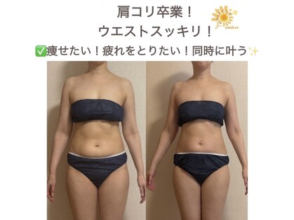 リュミエール(umiere)の写真