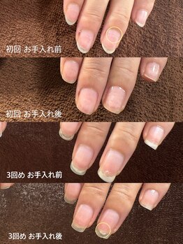 ビビィ(vivie)/ジェル卒業～育爪できるサロン