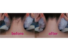 ダツモウ ミジュ(Datsumo MIJU)/