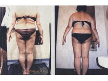 パーフェクトボディプレミアム 名古屋駅前店(PERFECT BODY PREMIUM)/お客様　ビフォーアフター（3）