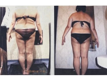 パーフェクトボディプレミアム 名古屋駅前店(PERFECT BODY PREMIUM)/お客様 ビフォーアフター(3)