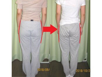 チャラク(charaku)/【30代I様：産後骨盤矯正】