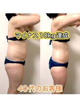 エステサロンクオーツ/全身痩身コース